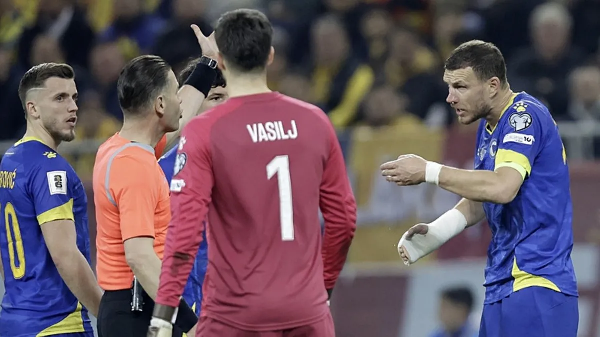 Dzeko’nun burnunda kırık tespit edildi!